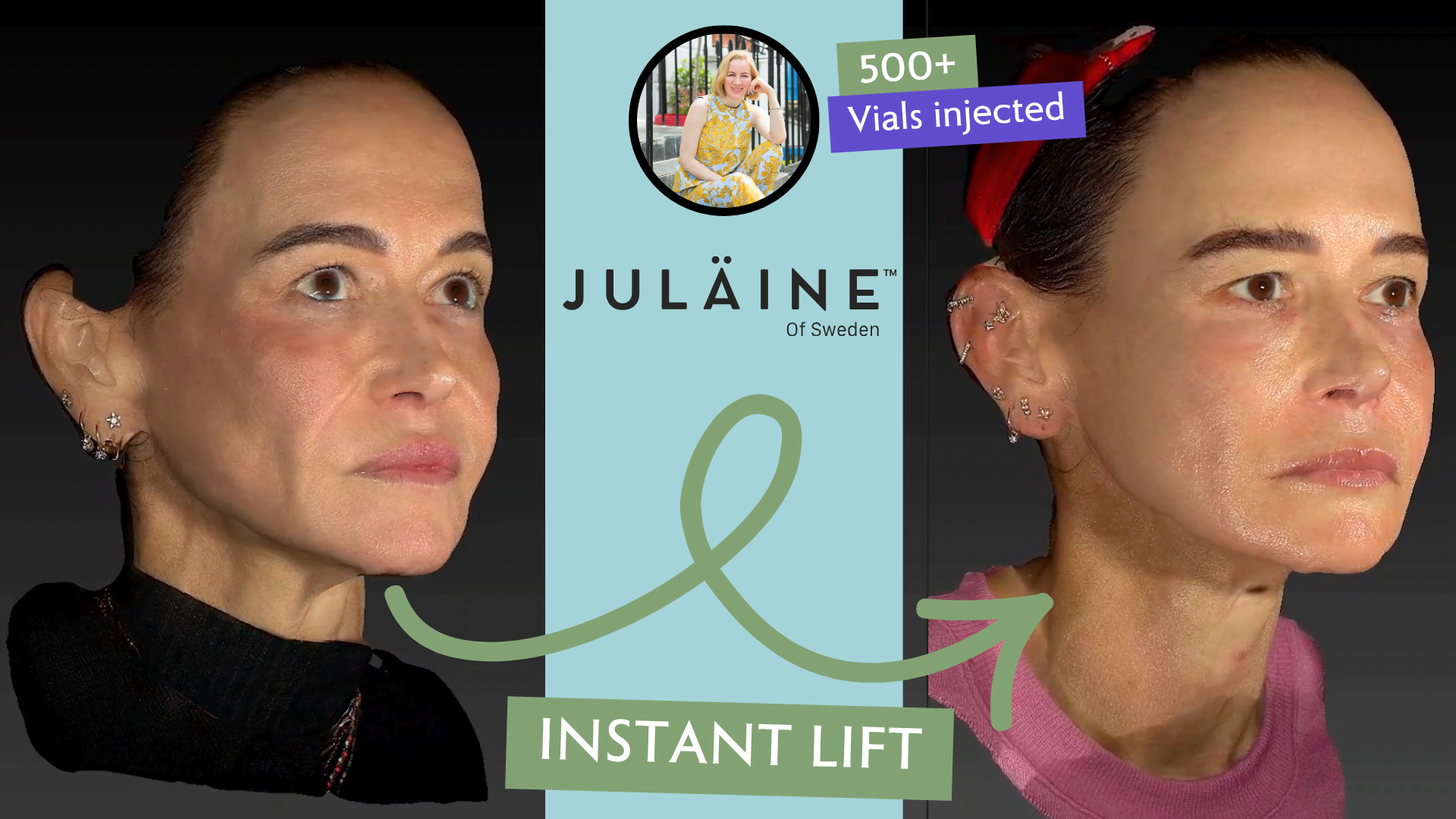 The Rise of JULÄINE™