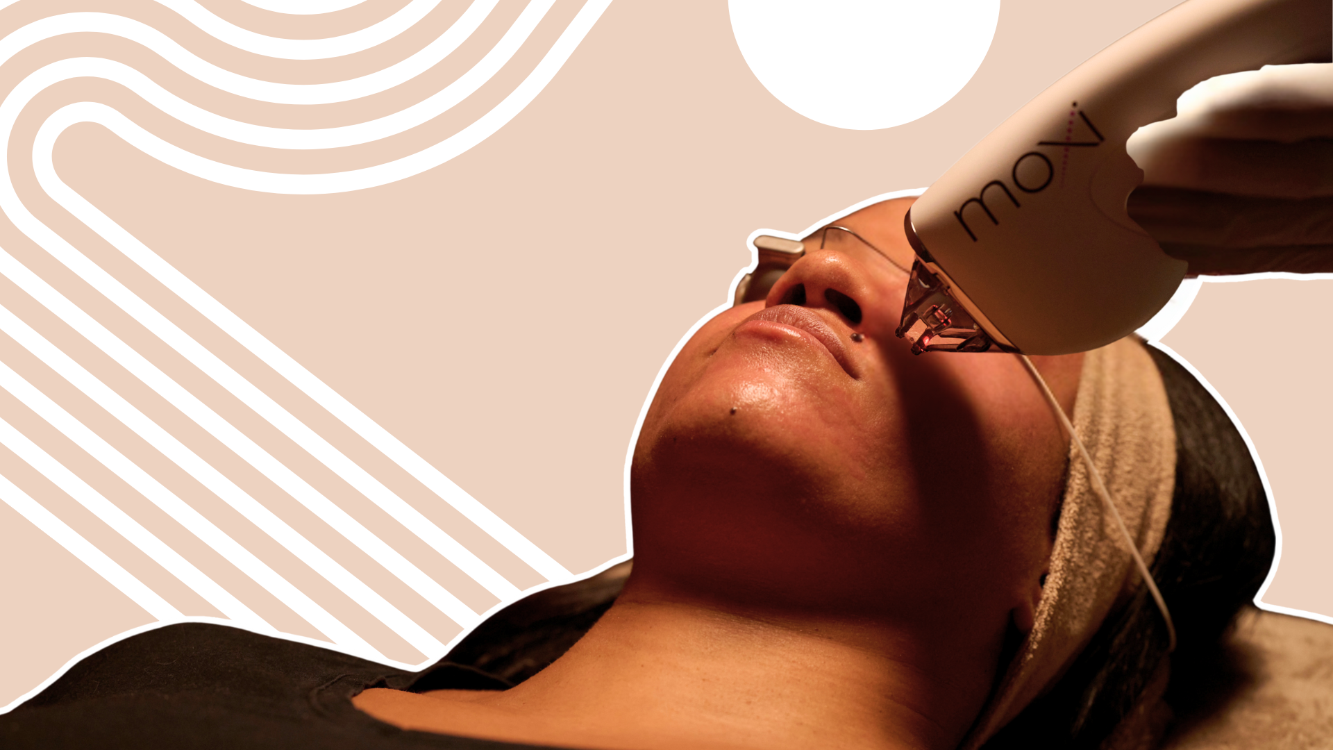 Post-Summer Pigmentation Treatment